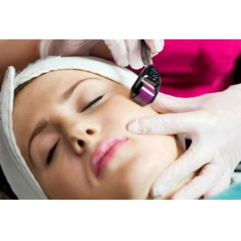 DermaRoller Microagulhamento 540 Agulhas – Sistema Original ANVISA para Preenchimento de Falhas.